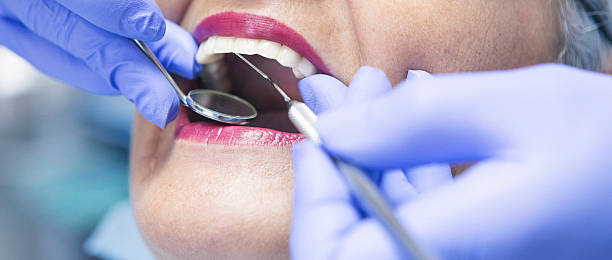 Best Teeth Whitening  in Montegut, LA